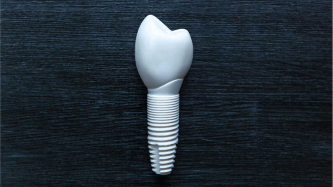 seramik-implant