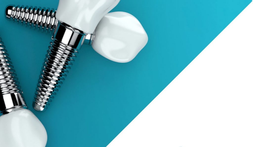 Dental İmplant Türleri